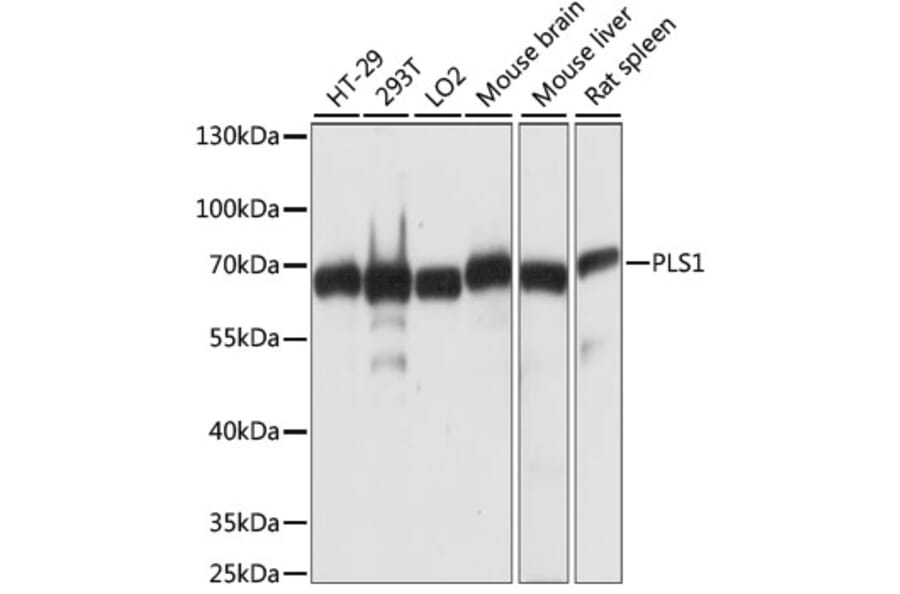 Western Blot - Anti-PLS1 Antibody (A90953) - Antibodies.com