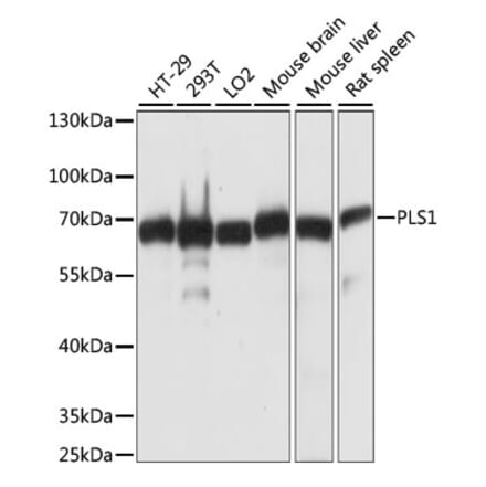 Western Blot - Anti-PLS1 Antibody (A90953) - Antibodies.com