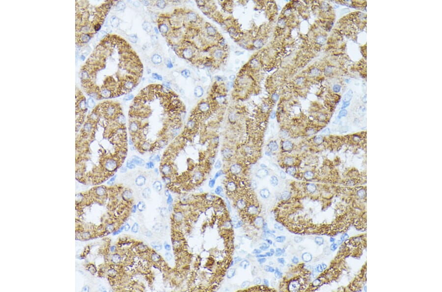 Immunohistochemistry - Anti-PLS1 Antibody (A90953) - Antibodies.com