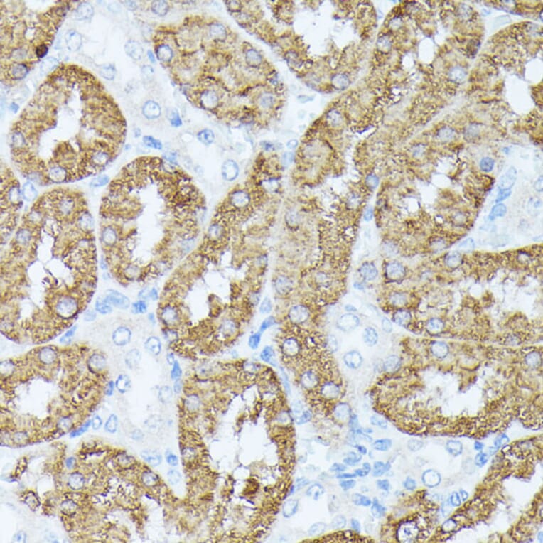 Immunohistochemistry - Anti-PLS1 Antibody (A90953) - Antibodies.com