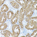 Immunohistochemistry - Anti-PLS1 Antibody (A90953) - Antibodies.com