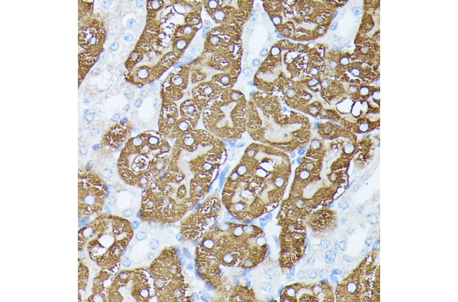 Immunohistochemistry - Anti-PLS1 Antibody (A90953) - Antibodies.com
