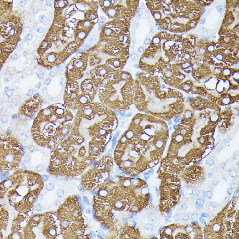 Immunohistochemistry - Anti-PLS1 Antibody (A90953) - Antibodies.com