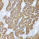 Immunohistochemistry - Anti-PLS1 Antibody (A90953) - Antibodies.com