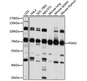 Western Blot - Anti-PGM2 Antibody (A90954) - Antibodies.com