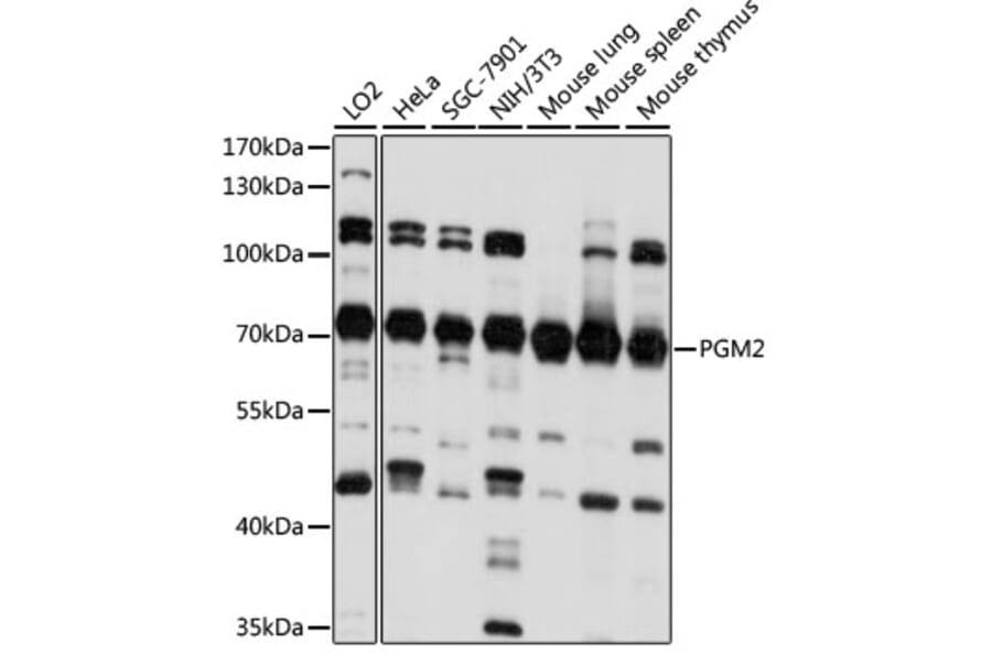 Western Blot - Anti-PGM2 Antibody (A90954) - Antibodies.com