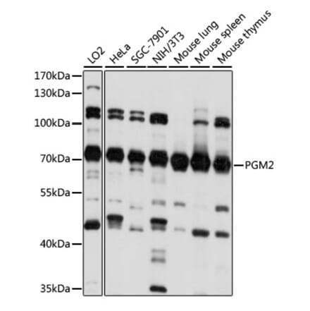 Western Blot - Anti-PGM2 Antibody (A90954) - Antibodies.com