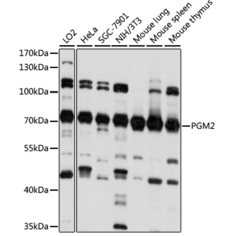 Western Blot - Anti-PGM2 Antibody (A90954) - Antibodies.com