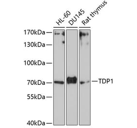 Western Blot - Anti-TDP1 Antibody (A90955) - Antibodies.com