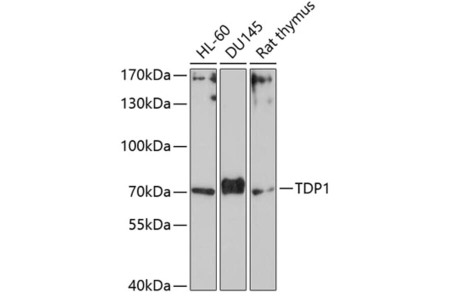Western Blot - Anti-TDP1 Antibody (A90955) - Antibodies.com