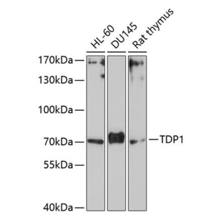 Western Blot - Anti-TDP1 Antibody (A90955) - Antibodies.com