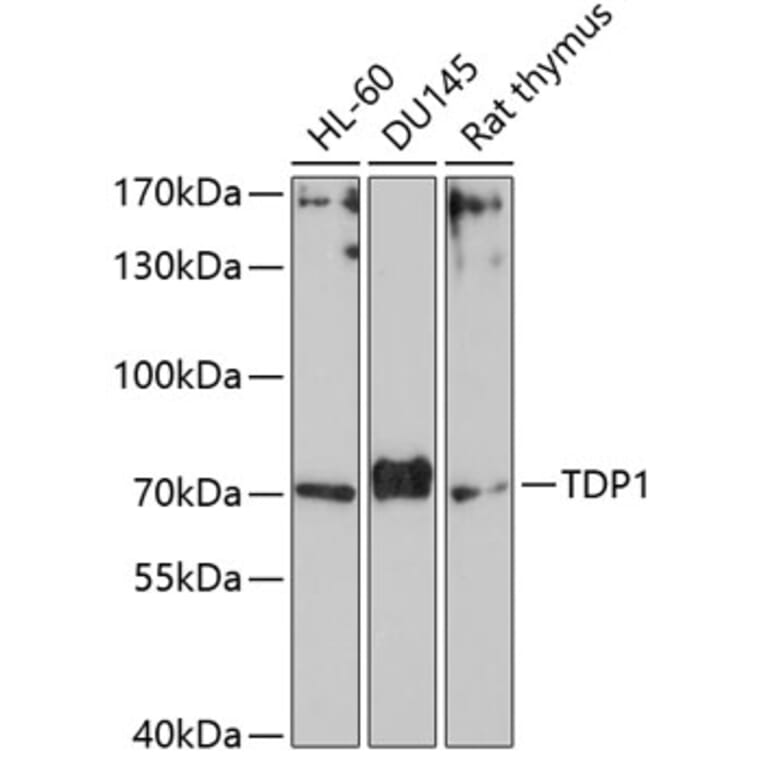 Western Blot - Anti-TDP1 Antibody (A90955) - Antibodies.com