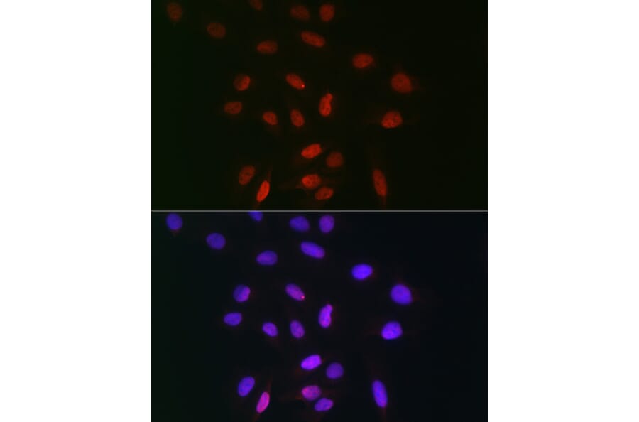 Immunofluorescence - Anti-TDP1 Antibody (A90955) - Antibodies.com