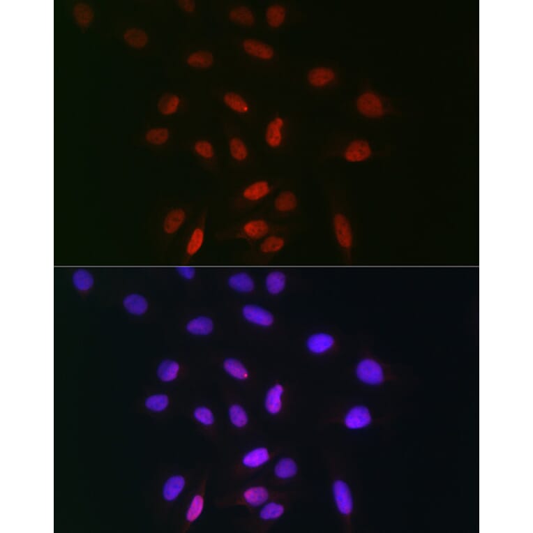 Immunofluorescence - Anti-TDP1 Antibody (A90955) - Antibodies.com