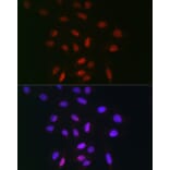 Immunofluorescence - Anti-TDP1 Antibody (A90955) - Antibodies.com