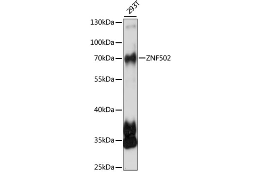 Western Blot - Anti-ZNF502 Antibody (A90956) - Antibodies.com