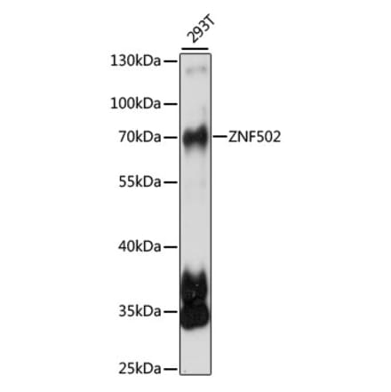 Western Blot - Anti-ZNF502 Antibody (A90956) - Antibodies.com