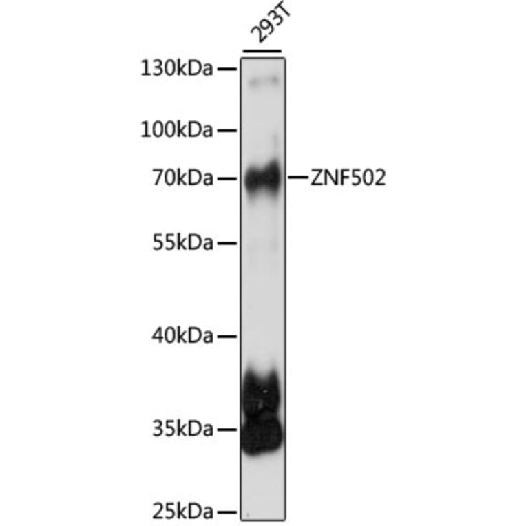 Western Blot - Anti-ZNF502 Antibody (A90956) - Antibodies.com