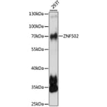 Western Blot - Anti-ZNF502 Antibody (A90956) - Antibodies.com