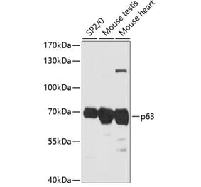 Western Blot - Anti-p63 Antibody (A90957) - Antibodies.com
