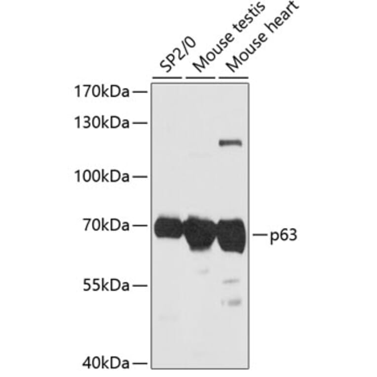 Western Blot - Anti-p63 Antibody (A90957) - Antibodies.com