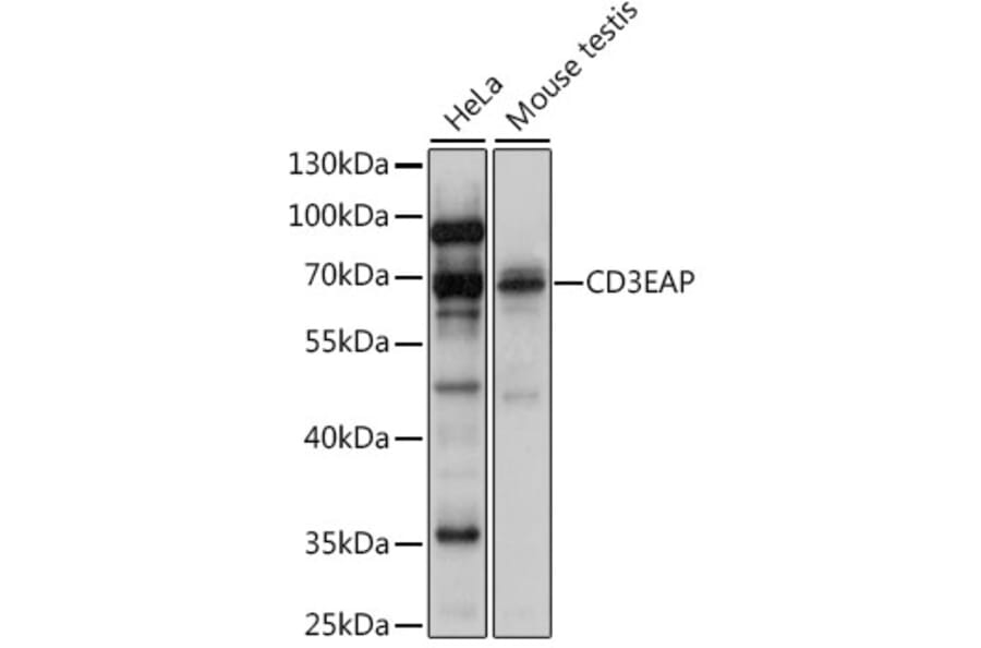 Western Blot - Anti-CAST Antibody (A90958) - Antibodies.com