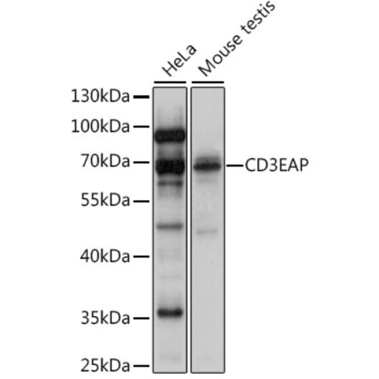 Western Blot - Anti-CAST Antibody (A90958) - Antibodies.com