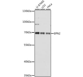 Western Blot - Anti-Epsin 2 Antibody (A90959) - Antibodies.com
