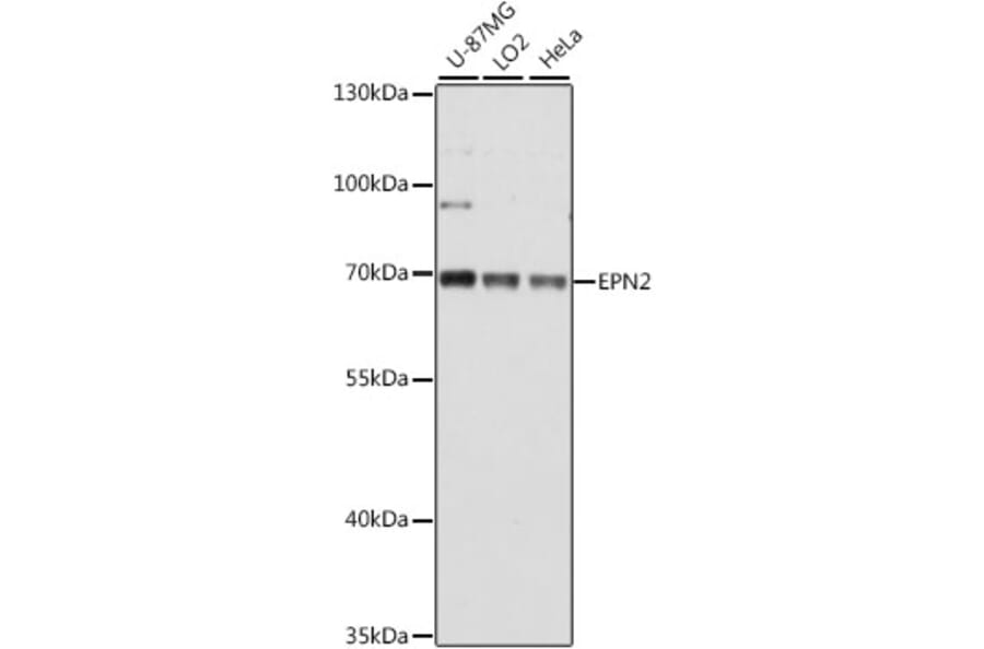 Western Blot - Anti-Epsin 2 Antibody (A90959) - Antibodies.com
