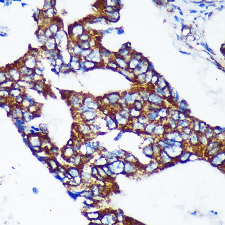 Immunohistochemistry - Anti-Epsin 2 Antibody (A90959) - Antibodies.com