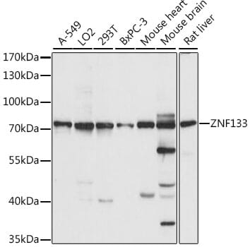 Western blot analysis of extracts of various cell lines, using Anti-ZNF133 Antibody (A15738) at 1:1,000 dilution.
Secondary antibody: Goat Anti-Rabbit IgG (H+L) (HRP) (AS014) at 1:10,000 dilution.
Lysates / proteins: 25µg per lane.
Blocking buffer: 3% non-fat dry milk in TBST.
Detection: ECL Basic Kit (RM00020).
Exposure time: 10s.