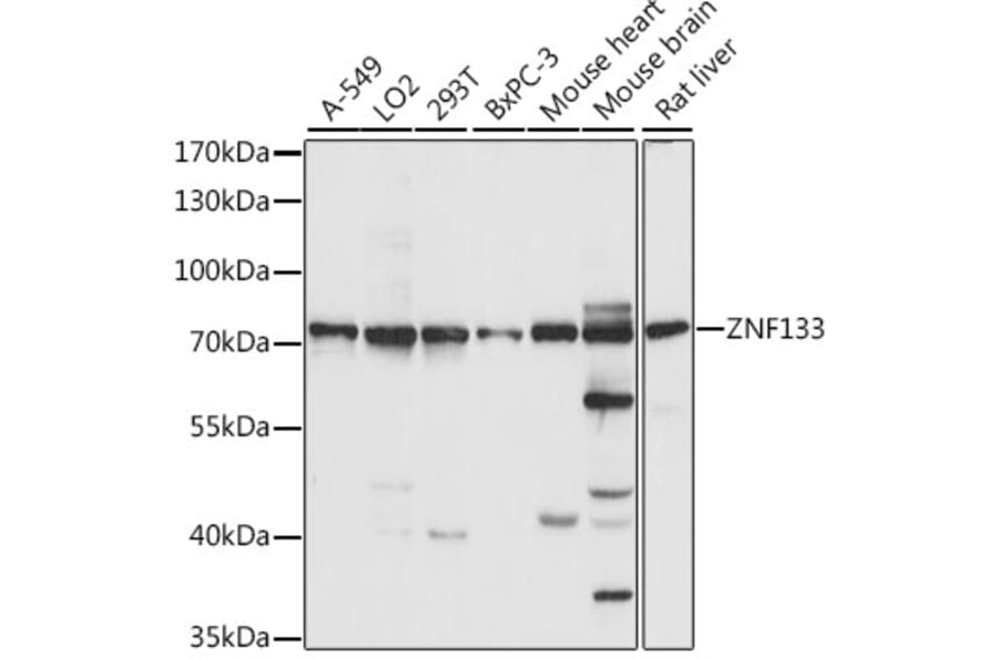 Western Blot - Anti-ZNF133 Antibody (A90960) - Antibodies.com