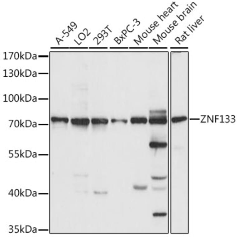 Western Blot - Anti-ZNF133 Antibody (A90960) - Antibodies.com
