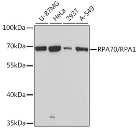 Western Blot - Anti-RPA70 Antibody (A90961) - Antibodies.com