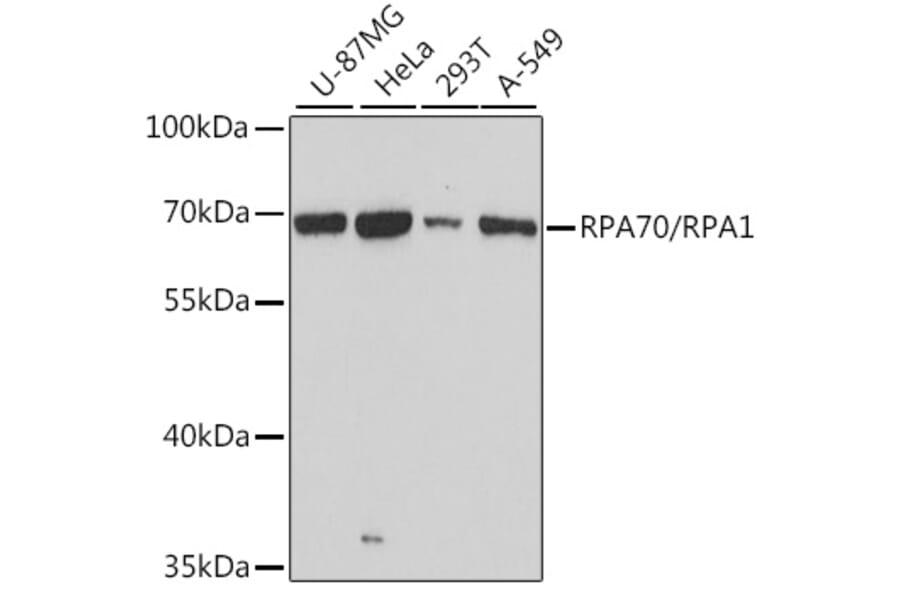 Western Blot - Anti-RPA70 Antibody (A90961) - Antibodies.com