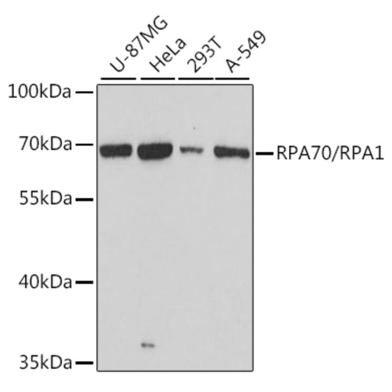 Western Blot - Anti-RPA70 Antibody (A90961) - Antibodies.com