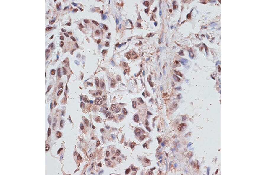 Immunohistochemistry - Anti-RPA70 Antibody (A90961) - Antibodies.com