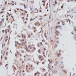 Immunohistochemistry - Anti-RPA70 Antibody (A90961) - Antibodies.com