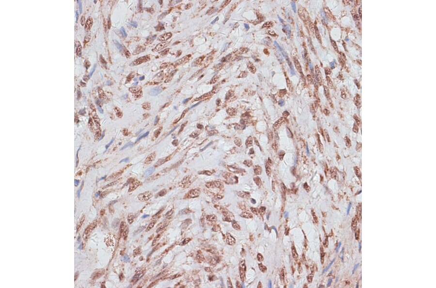 Immunohistochemistry - Anti-RPA70 Antibody (A90961) - Antibodies.com