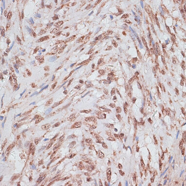 Immunohistochemistry - Anti-RPA70 Antibody (A90961) - Antibodies.com