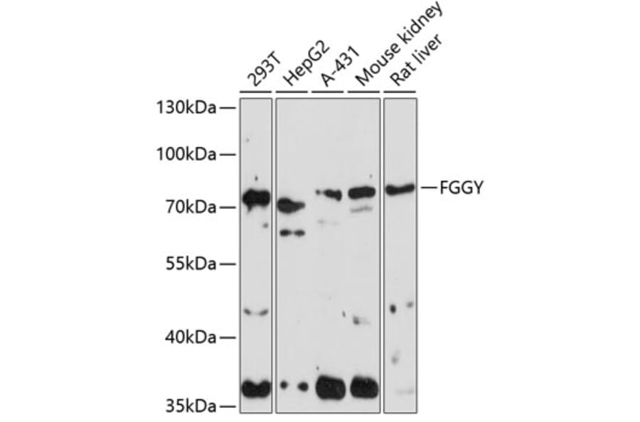 Western Blot - Anti-FGGY Antibody (A90962) - Antibodies.com