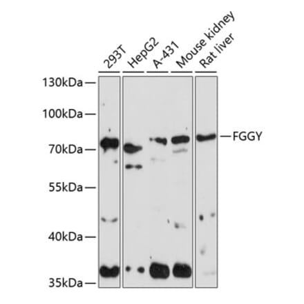 Western Blot - Anti-FGGY Antibody (A90962) - Antibodies.com