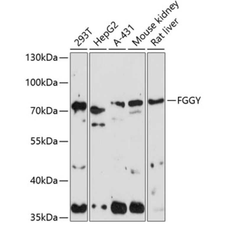 Western Blot - Anti-FGGY Antibody (A90962) - Antibodies.com