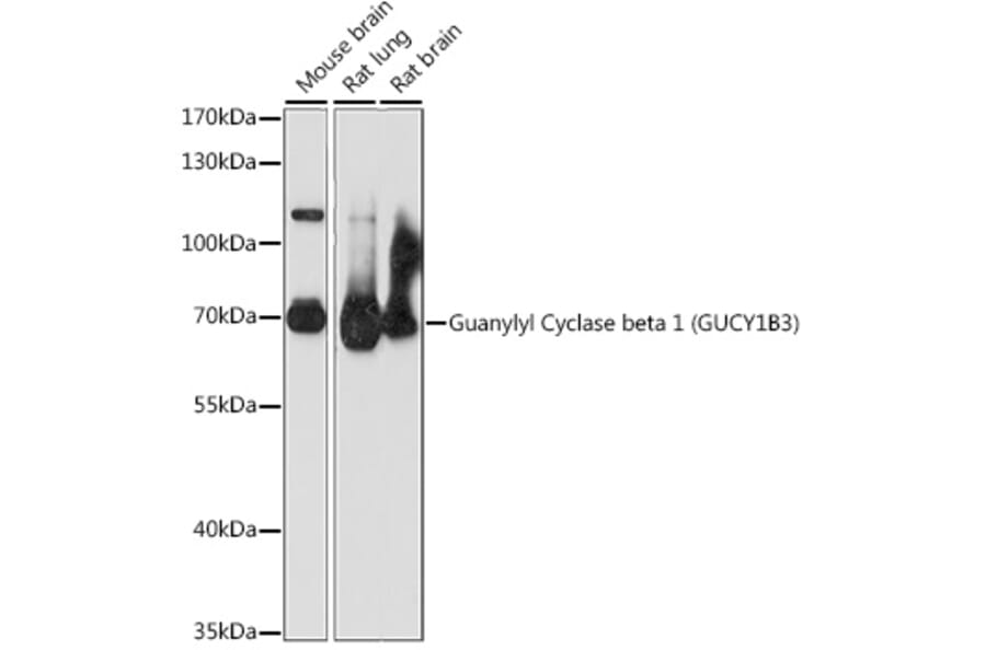 Western Blot - Anti-GUCY1B3 Antibody (A90963) - Antibodies.com