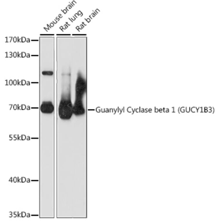 Western Blot - Anti-GUCY1B3 Antibody (A90963) - Antibodies.com