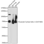 Western Blot - Anti-GUCY1B3 Antibody (A90963) - Antibodies.com