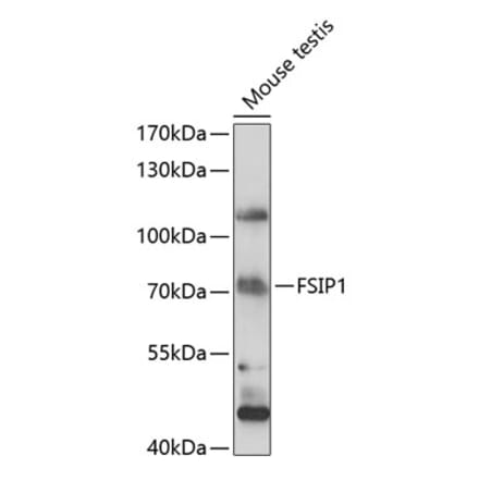 Western Blot - Anti-FSIP1 Antibody (A90965) - Antibodies.com