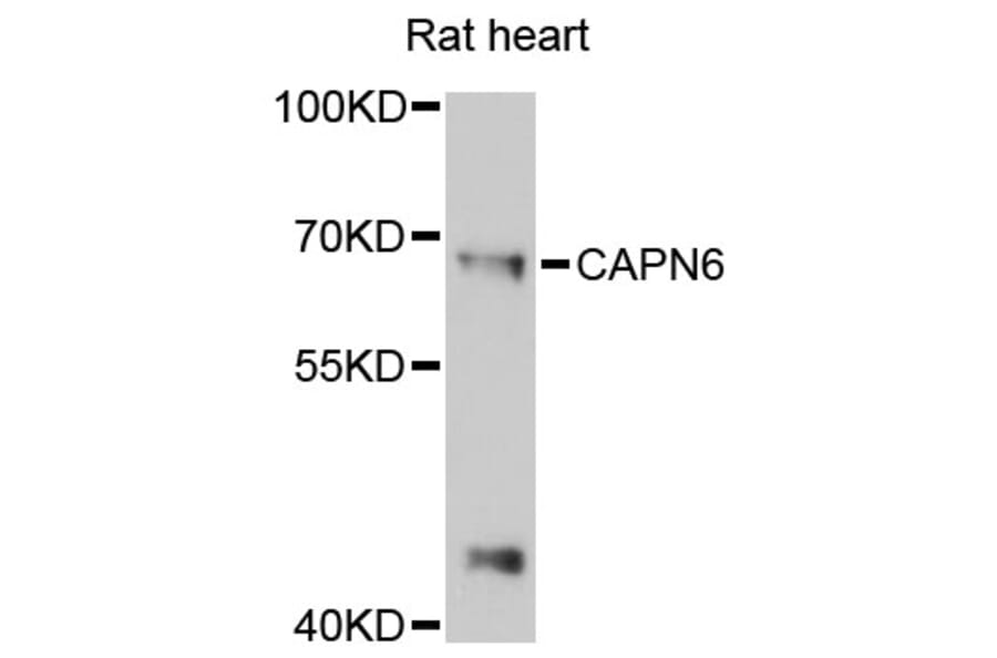Western Blot - Anti-CAPN6 Antibody (A13777) - Antibodies.com