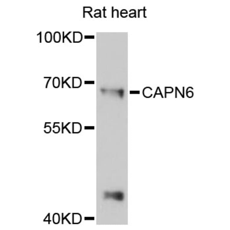 Western Blot - Anti-CAPN6 Antibody (A13777) - Antibodies.com