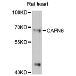 Western Blot - Anti-CAPN6 Antibody (A13777) - Antibodies.com